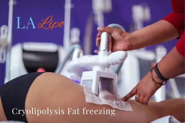 women getting fat freezing Bexleyheath