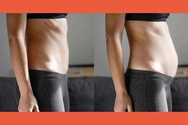 LA-EMS Body Sculpting results Bexleyheath